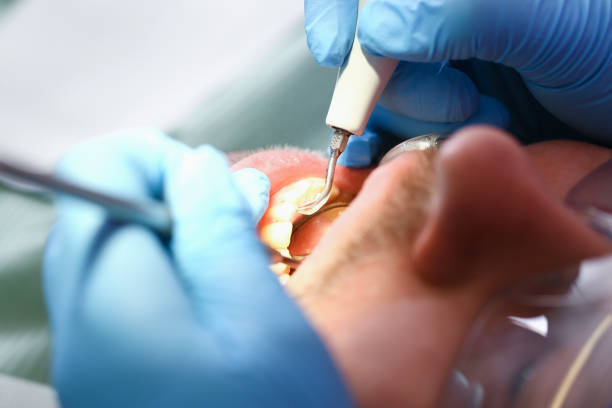 Best Dentist for Tooth Abscess  in Fox Lake Hls, IL